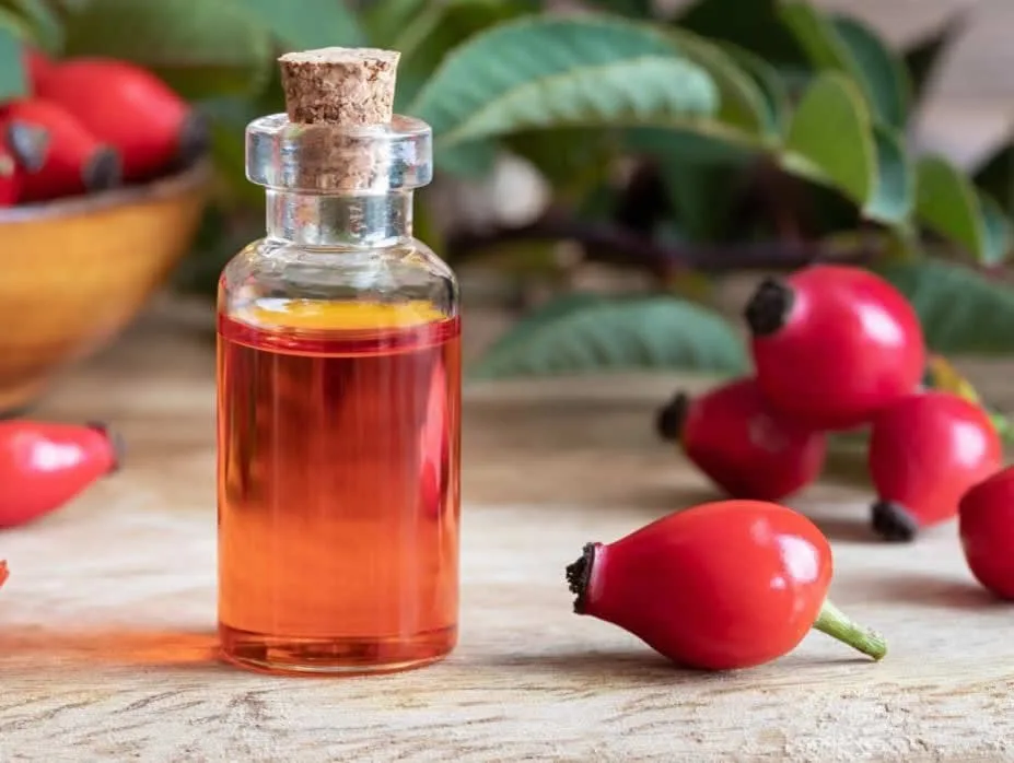 Aceite para estrías